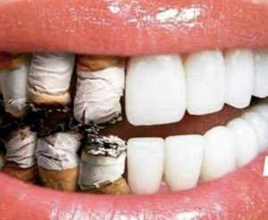 Smoking- mouth disease
