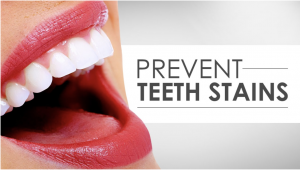 prevent teeth stains
